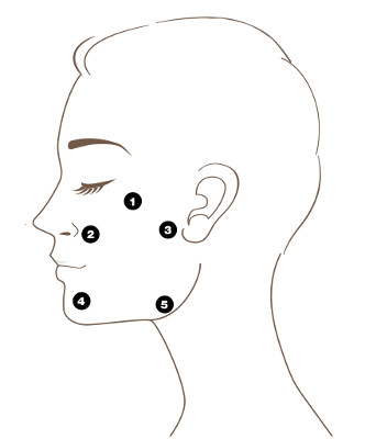 Areas that can be treated with the Profhilo® Treatment