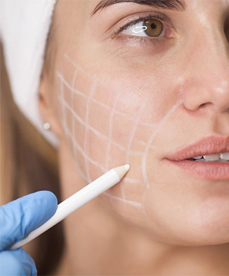 Dermal fillers