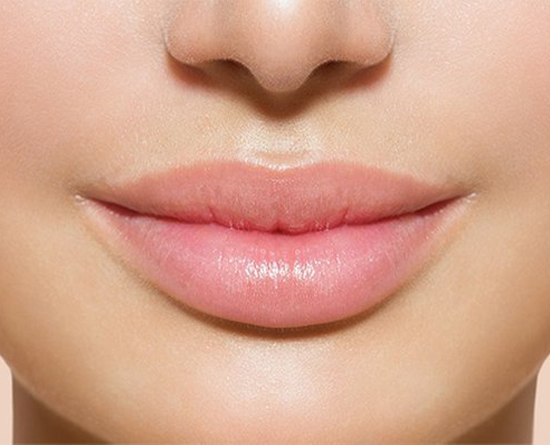 Lip fillers