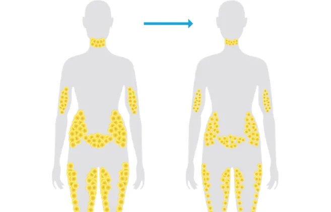 Fat cells after normal weight loss